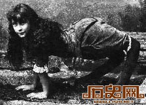 盘点人类历史上九大怪胎