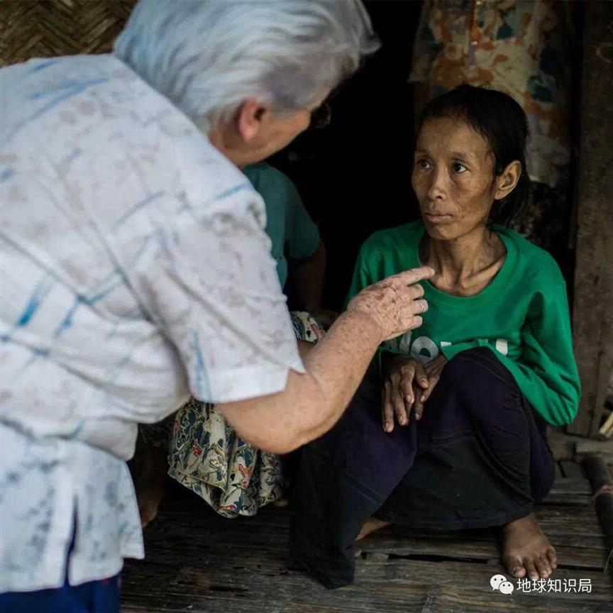 这种病，害死了鲁迅｜地球知识