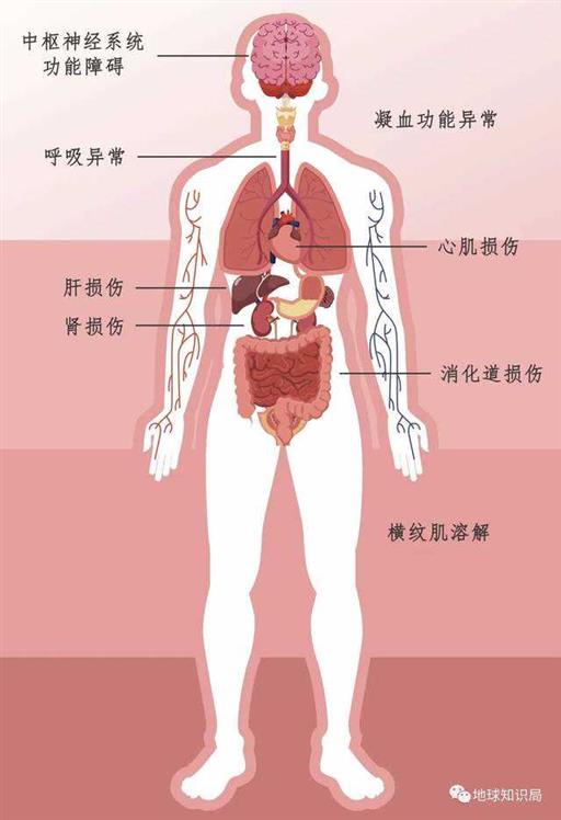 太热了，把人热出热射病了 | 地球知识局