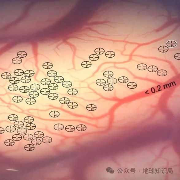 美国最新技术来了，专搞人的脑子 | 地球知识局