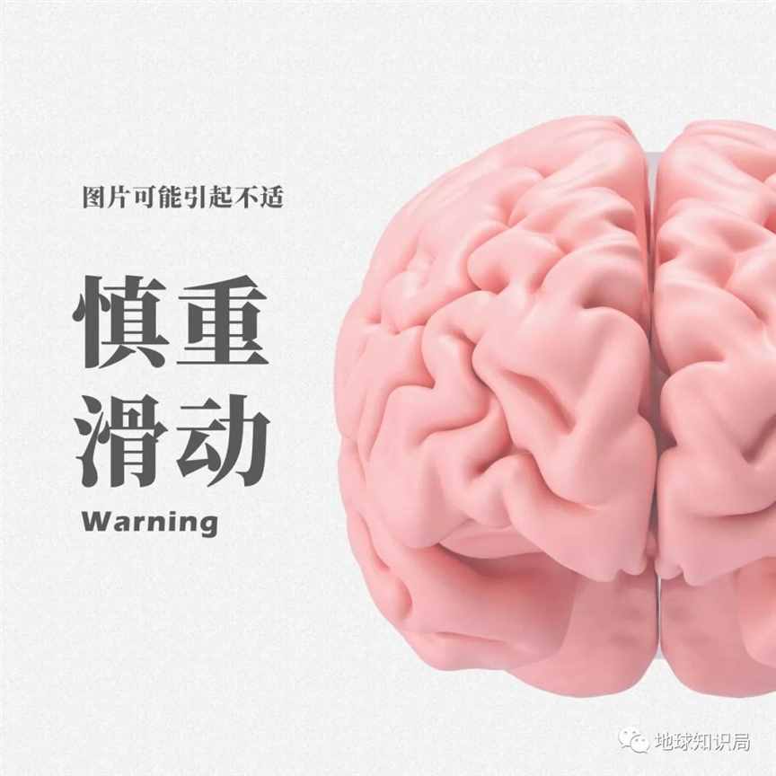 这种病，让人变成丧尸？| 地球知识局