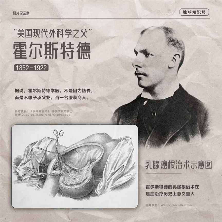 乳房第一杀手，每年两百多万 | 地球知识局