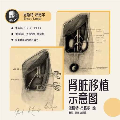 4.7万人，都在等着换腰子 | 地球知识局