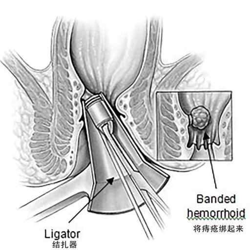 中国哪个省，痔疮比例最高? | 地球知识局
