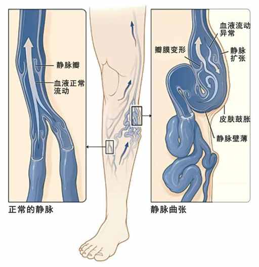 中国哪个省，痔疮比例最高? | 地球知识局